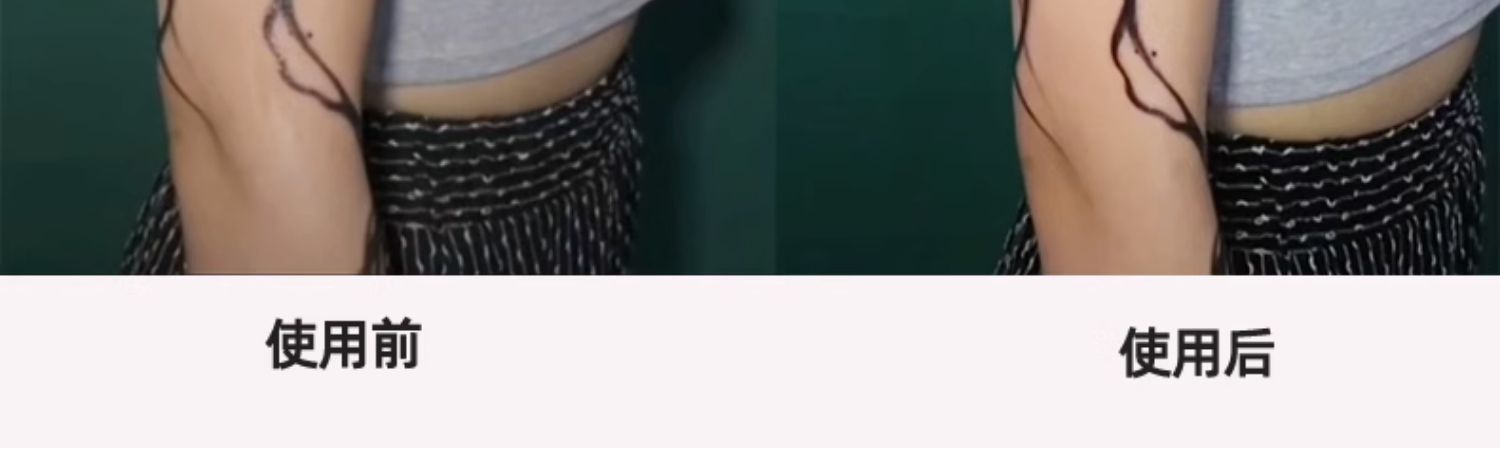 手机CPL偏振镜头过滤水面反光滤镜通用单反相机偏光镜 拍纹身镜头 苹果13华为通用14拍美食玻璃植物降低反光