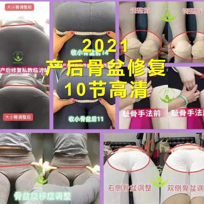 Post2021 Postpartum Pelvic Assessment Methods of Stereo Separation and Narrow Hip Learning