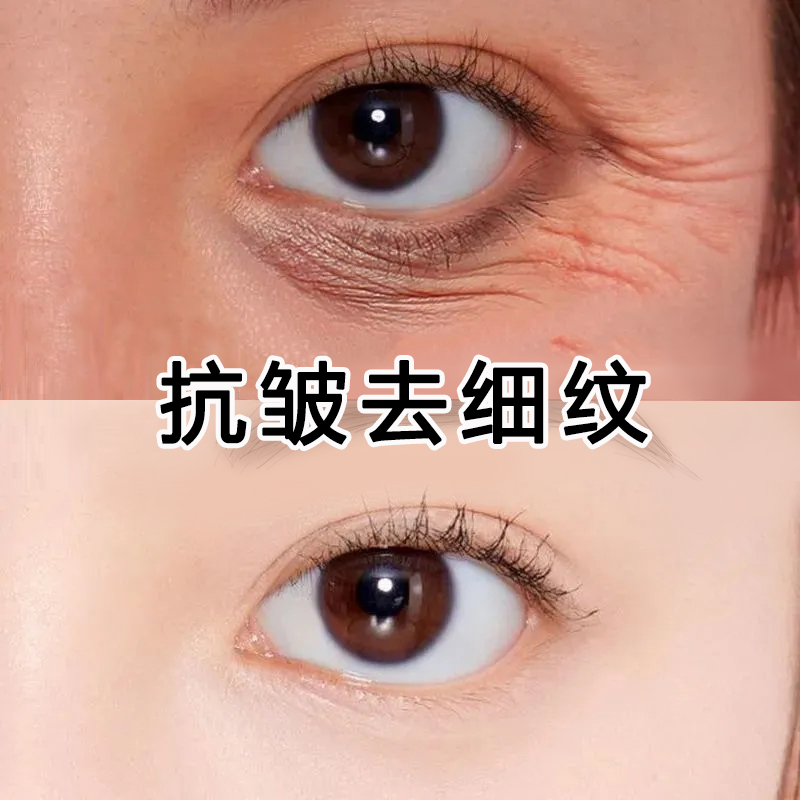 Crow's feet eye mask to remove the corners of the eyes, tightening, anti-wrinkle, small iron, wrinkle, fine lines, anti-aging artifact