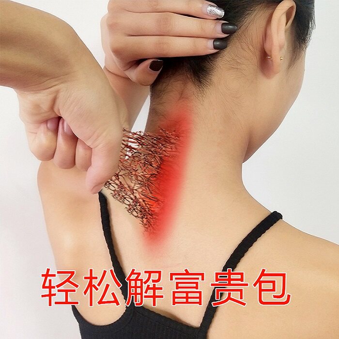 (100,000 people are in use) As long as the rich do not cover to solve various cervical spine problems buy 3 rounds of 5 a course of treatment