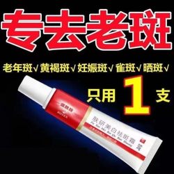 Ointment for removing age spots. Special ointment for hands and face. One-touch ointment for removing melanin for the elderly.