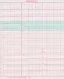Sanrui Monitoring Remoring Remoring Remorning Paper Monitoring Medical Hot -чувствительная бумага 150*90 152*90 Ciman Richard