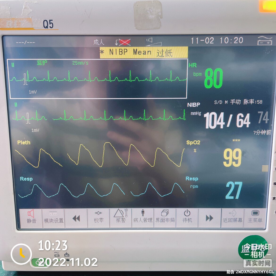 （维修）BLT宝莱特Q5监护仪触摸屏参数板显示屏主板电源电池