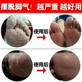 Спортсмен медицина осушила и снимает очистку ног.