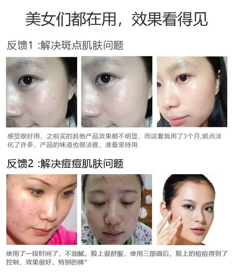 Hồng Kông Kem bất tử Lady Cream Chính hãng Pearl Pl Nhaua Kem Kem che khuyết điểm Kem dưỡng ẩm buổi sáng 38g - Kem dưỡng da