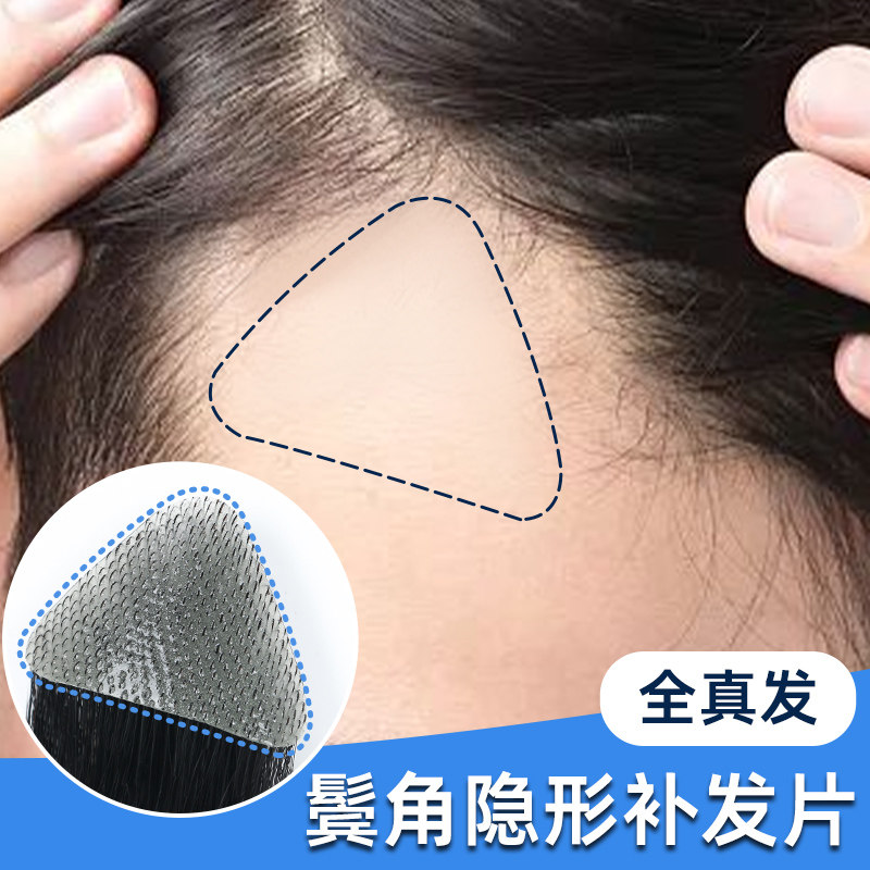 Intertexline post Male Temples Corner Wig men forehead Forehead Tonic Hair invisible m Type of hair Line sticker Liu Hai forehead Wig Piece-Taobao