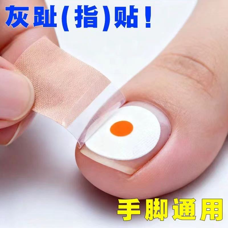 【Hong Kong Pharmacy】Authentic Nail Stickers for Specialized Use, Plant-Derived, Specifically for Toenails and Fingernails