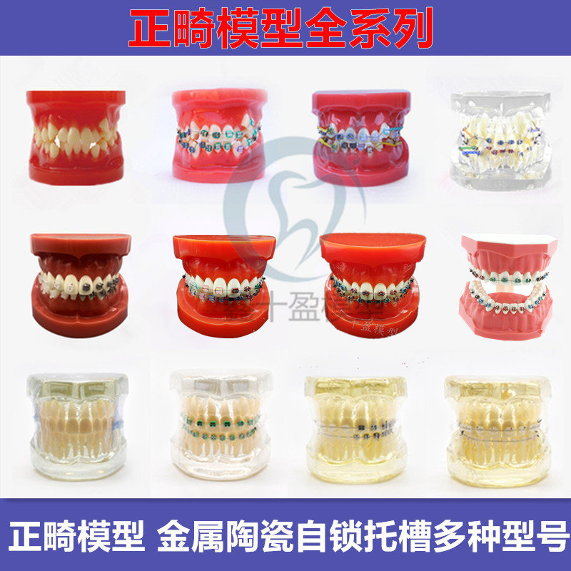 牙科口腔4种托槽对比模型 正畸陶瓷金属自锁托槽托槽示范模型包邮