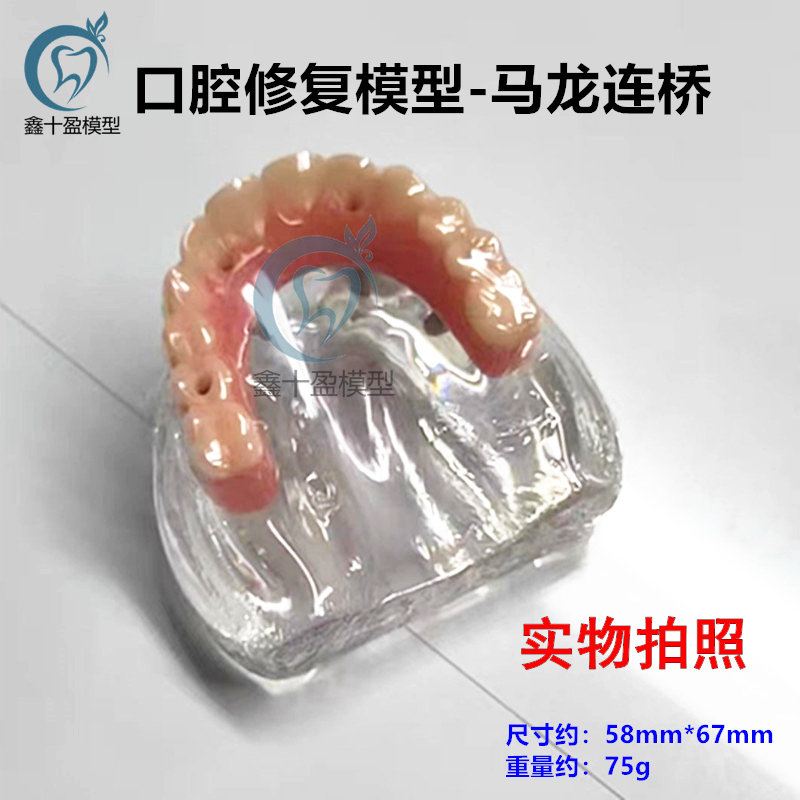 牙科口腔模型马龙连桥义齿修复种植牙齿仿真演示模拟教学医患交流