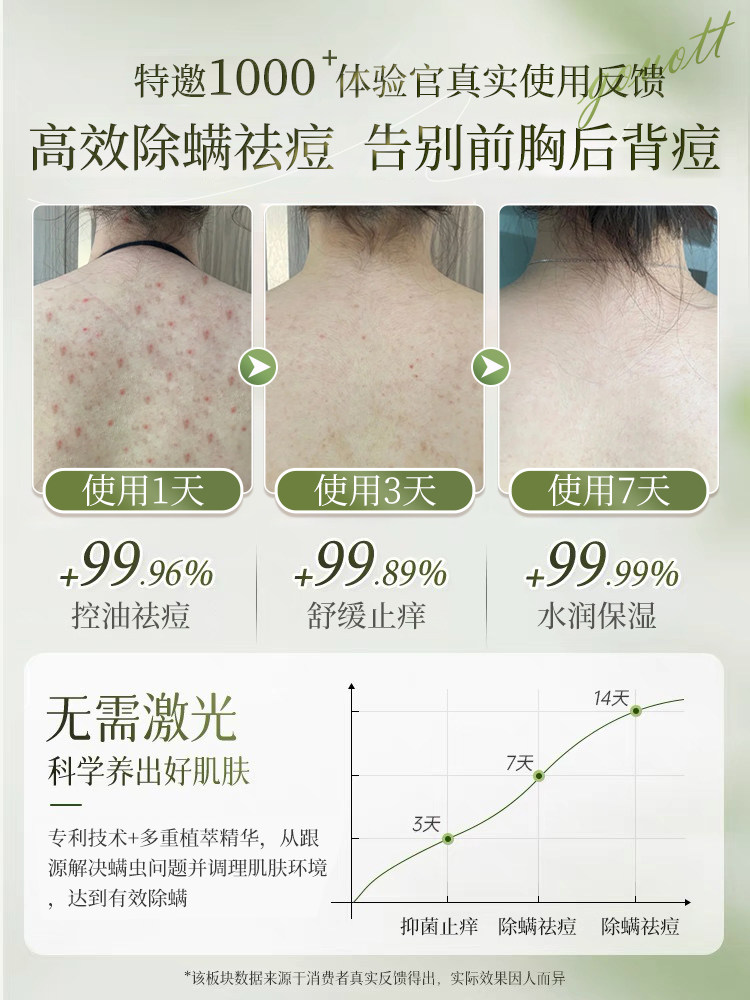 Anti-Mite Shower Gel, Anti-Acne, Back Acid Exfoliation, Long-Lasting Fragrance, Spring and Summer Moisturizing, Official Brand Flagship Store