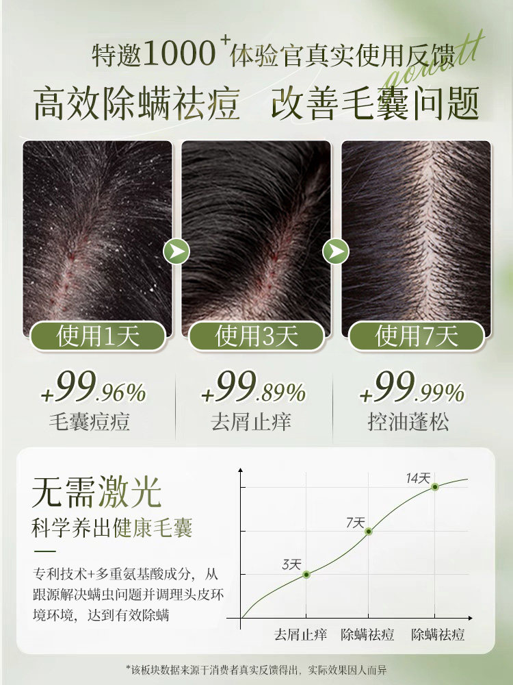 Folliculitis Shampoo, Oil Control, Fluffy, Anti-Dandruff, Anti-Mite, Scalp Cleansing, Anti-Itching, Amino Acid Genuine Shampoo for Men and Women