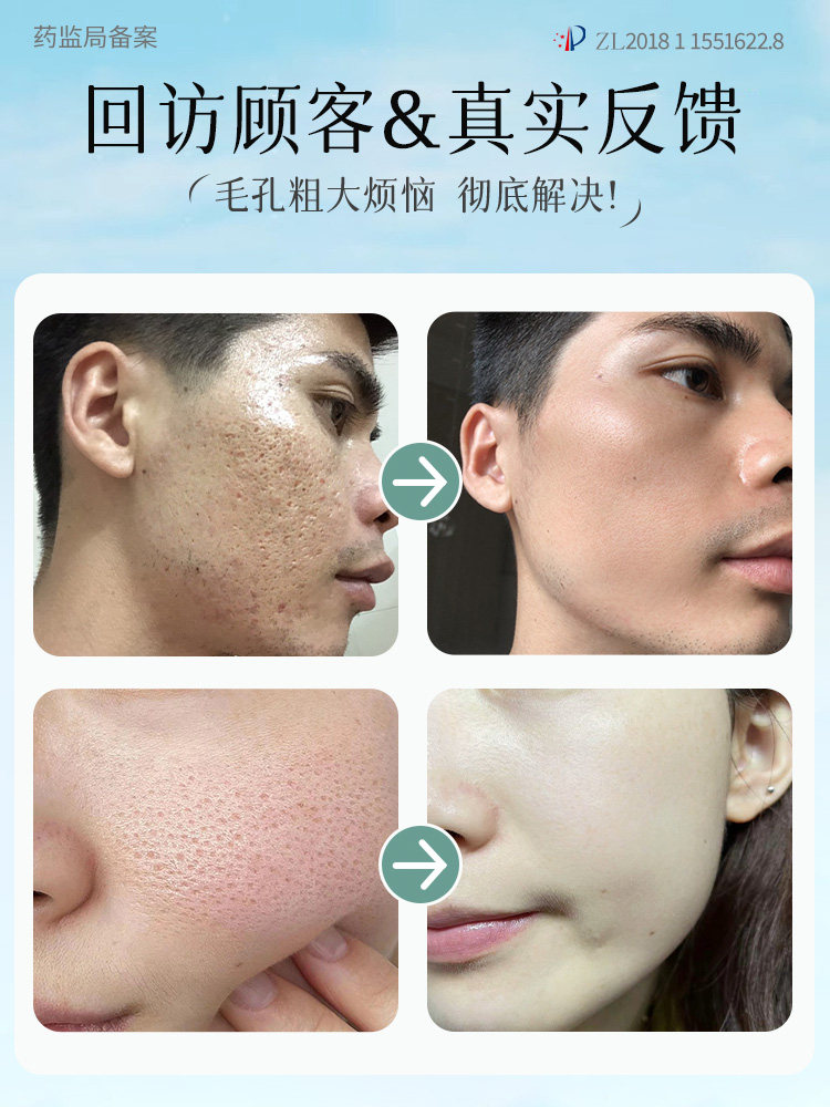 Large Pores Shrinkage and Repair, Salicylic Acid Pore Shrinking Essence, Removes Acne, Removes Blackheads and Acne, Deep Cleansing