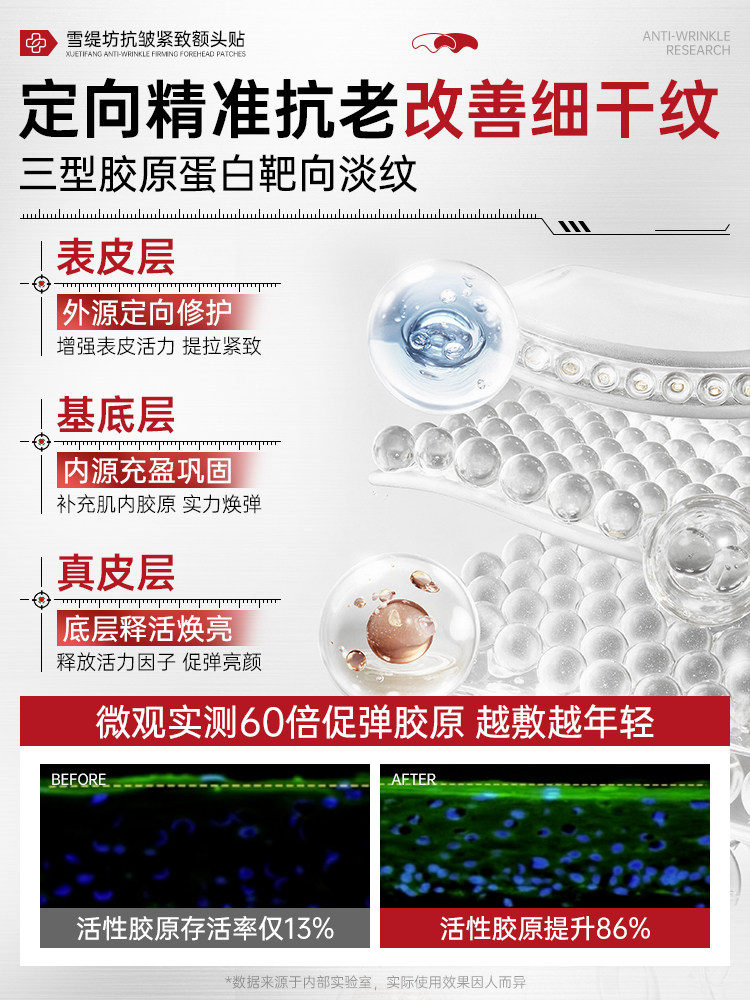 Forehead Wrinkle Removal Tool, Forehead Lifting and Tightening, Sleep Wrinkles, for Men and Women, Official Flagship Store