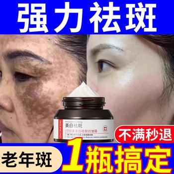 Official Flagship Store of Freckle Removal Cream, No. 1 in Authenticity, Removes Chloasma, Age Spots, Lightens Spots, Whitens and Fades Pigmentation