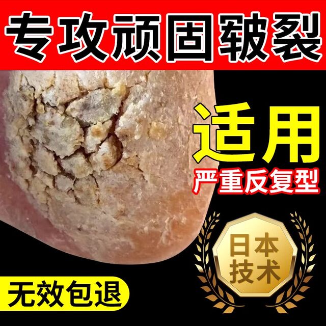 Heel Crack Repair Cream, Hard Skin Remover, Moisturizing Cream for Cracked Heels, Peeling and Rough Skin Cream