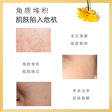 Отшелушивающая ромашка, отшелушивающий косметический гель для лица от черных точек, очищение пор, для салонов красоты