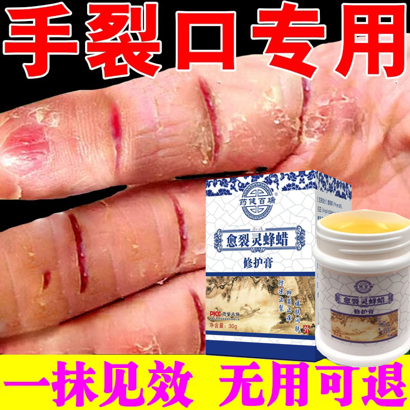 Hand Split Dry Crack Repair Cream Autumn Winter Nail Stitch Dry Crack Finger Peeling Cracking Hand Foot Heel Oil Chapped Cream-Taobao