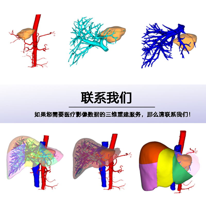 Ct Data 3D Reconstruction, Liver 3D Visualization, 3D Printed Medical Model, Dicom Mri Converted to Stl Ct Data 3D Reconstruction, Liver 3D Visualization, 3D Printed Medical Model, Dicom Mri Converted to Stl