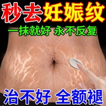 Stretch Marks Elimination Stretch Marks Firming Belly Obesity Marks Medical Male Postpartum Repair Cream Scar Removal Cream