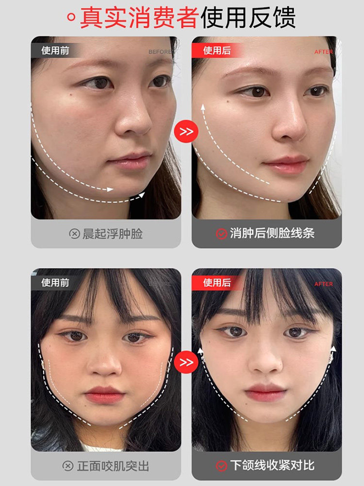 Small V-Face Slimming Tool, Facial Lifting and Tightening Roller Beauty Device for Neck Slimming, Double Chin Reduction, and Masseter Muscle Reduction