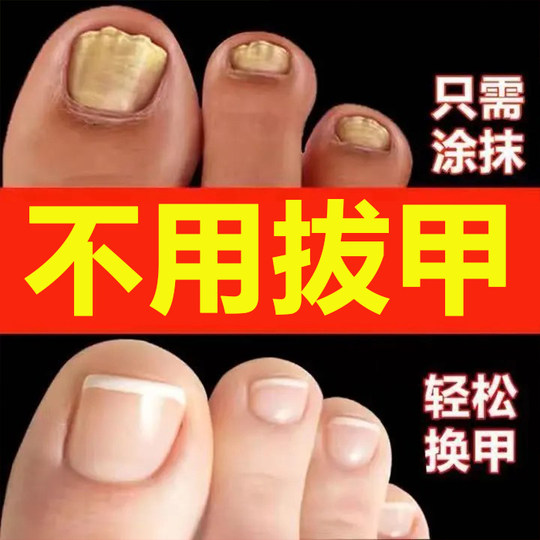 Ремонт поврежденных ногтей, утолщение вогнутых и выпуклых ростов, жидкое средство для восстановления маникюра, регенеративное питательное масло для пальцев и ногтей на ногах