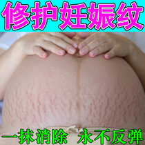 Special ointment for diluting stretch marks removing obesity marks growth marks long abdominal lines red lines atrophic lines and expansion marks