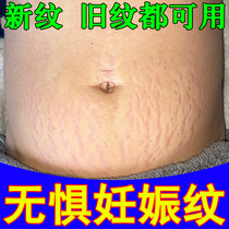 Powerful postpartum repair cream to remove stretch marks firm and fade growth marks special ointment for pregnant women to eliminate obesity marks