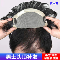 Wig mens head overhead tonic block short hair real hair inches nature invisible front forehead bald tops mens wig pieces