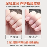 Питательное масло для ногтей, питательное масло для пальцев, лечебный отшелушивающий восстанавливающий гель-лак для маникюра