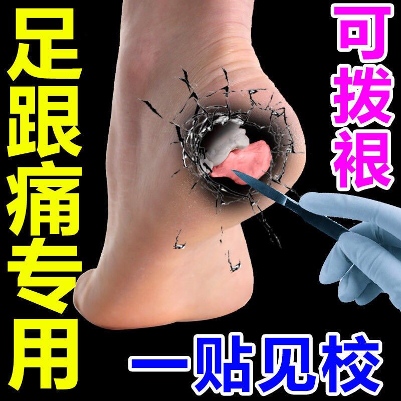 Heel pain special paste foot prick heel pain foot bare foot plantar pain fascia paste to root Achilles tendonitis paste