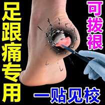 Heel pain special paste foot stab heel pain foot bare sole sole pain fascia paste to root Achilles tendonitis paste