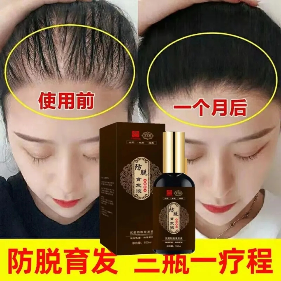 Mian Steen Mian Steen Mian Ending Steen Chinese herbal Han and hair growth lotion anti-hair loss tonic