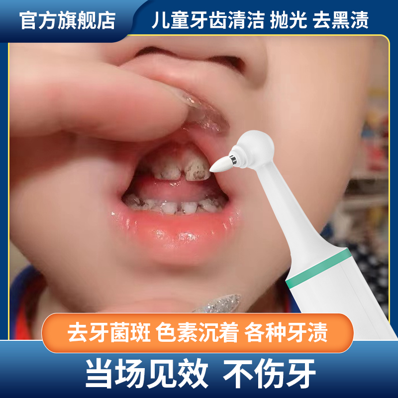 子供の歯のクリーニングと研磨装置、色素沈着、赤ちゃんの歯垢を除去し、小さな黒い歯を洗浄し、歯の汚れや歯石のアーティファクトを除去します