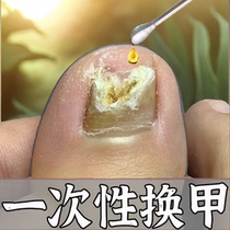 (Watsons best-selling) One drop of it can inhibit bacteria without removing nails and remove 99% of gray potassium fungi. If invalid return guarantee