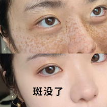 No scabs no cleansing guaranteed~remove all dark spots and spots on the face cleansing and removing dark spots (the effect is very good) 2 get 1 free
