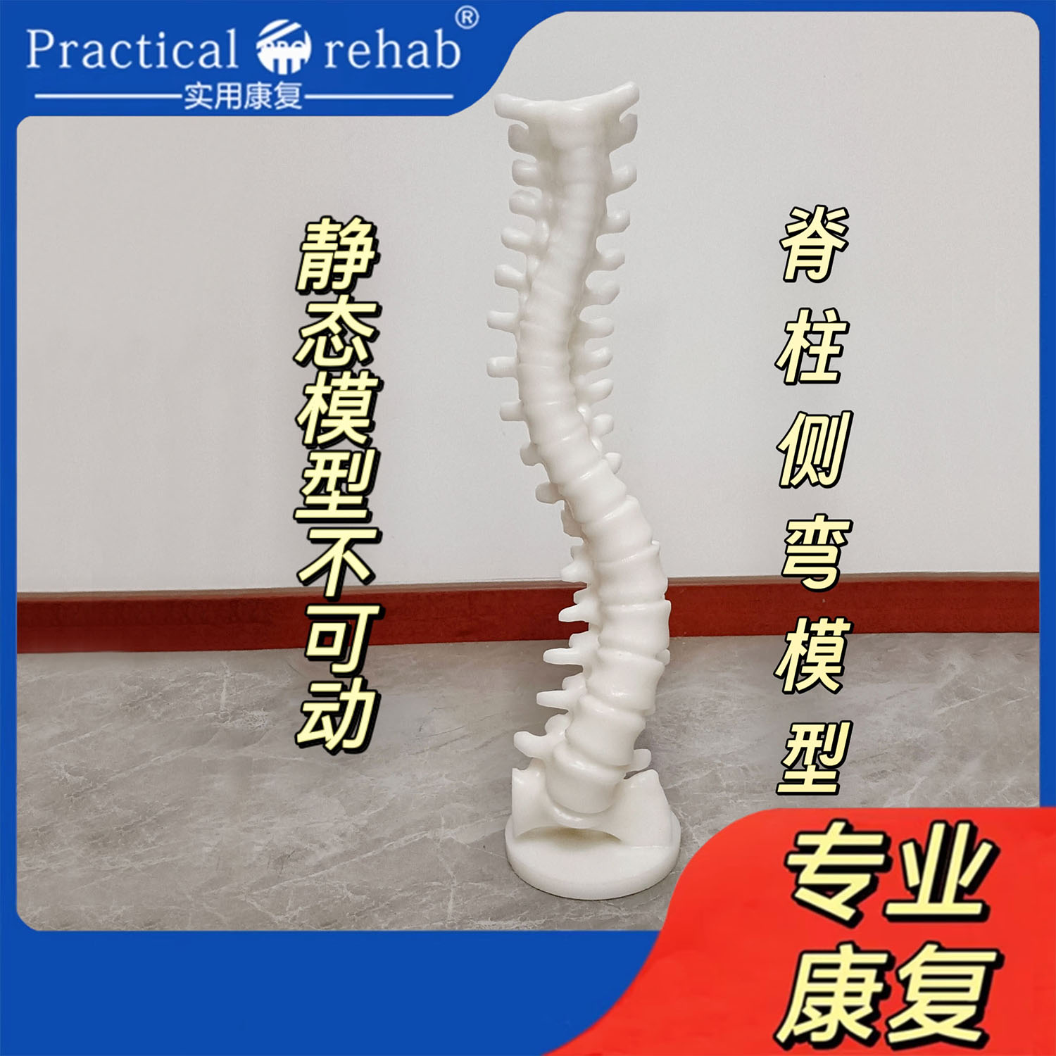 脊柱塑形脊柱侧弯模型