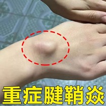 (No need for a small needle knife) Specializes in tendon sheath inflammation tendon sheath swelling thumb joint swelling wrist pain and pain relief cream