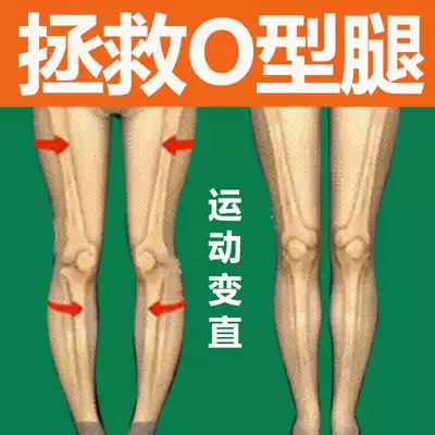 O-leg X-type xo-leg looped leg orthotics male star recommended calf valgus correction leg artifact straight leg