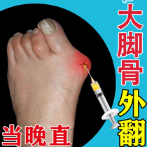 (200% Genye) Thumb Valgus Patch a magic device for correcting thumb overlapping and big foot bone deformation special ointment patch