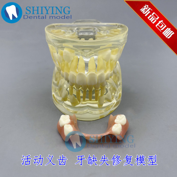 牙科口腔乳恒交替模型 牙列发育牙模 活动义齿模型牙缺失修复7019