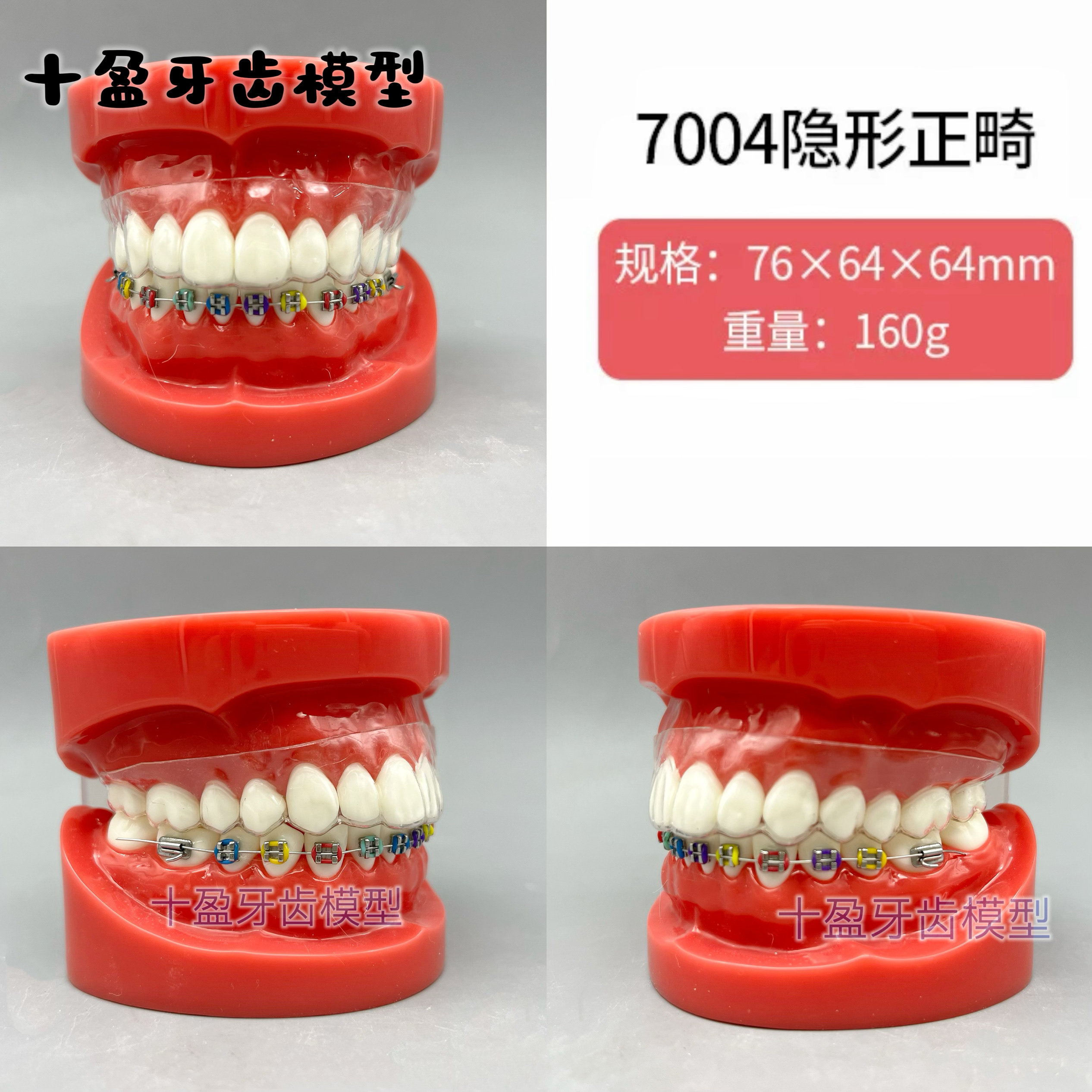 牙科口腔4种托槽对比模型 正畸陶瓷金属自锁托槽托槽示范模型包邮