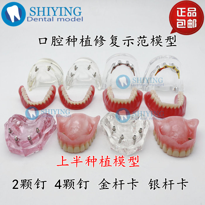 种植体修复模型种植钉球帽结合覆盖义齿口腔模型齿科修复模型包邮
