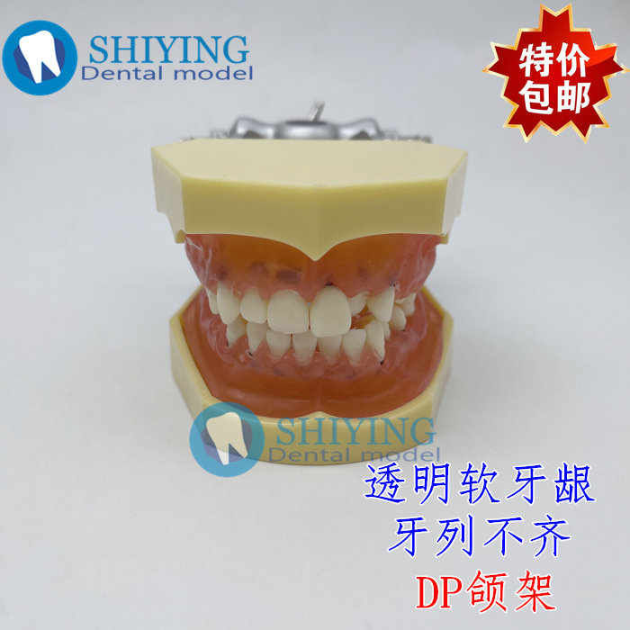 牙科口腔教学模型 牙周病理模型 练习牙结石刮治医患沟通4003包邮