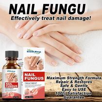 Nail Fungal Treatment Essence Onychomycosis Paronychia Anti