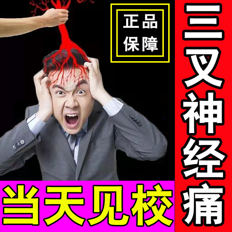 Stubborn migraine trigeminal nerve Headache Menstrual Wind Chill Dizzy relieve discomfort massage Stickler Headache Cream