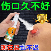 Rapid wound healing scab shengjiling burns burns abrasions hemostatic topical ointment post-surgery removal and myogenic spray