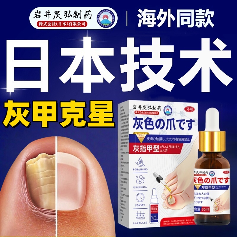 Japanese Special Effect Genuine Product One Drop Clean Nail Fungus Liquid, the Number One Special Solution for Treating Nail Fungus, Phyllodendron Flower Liquid for Nails