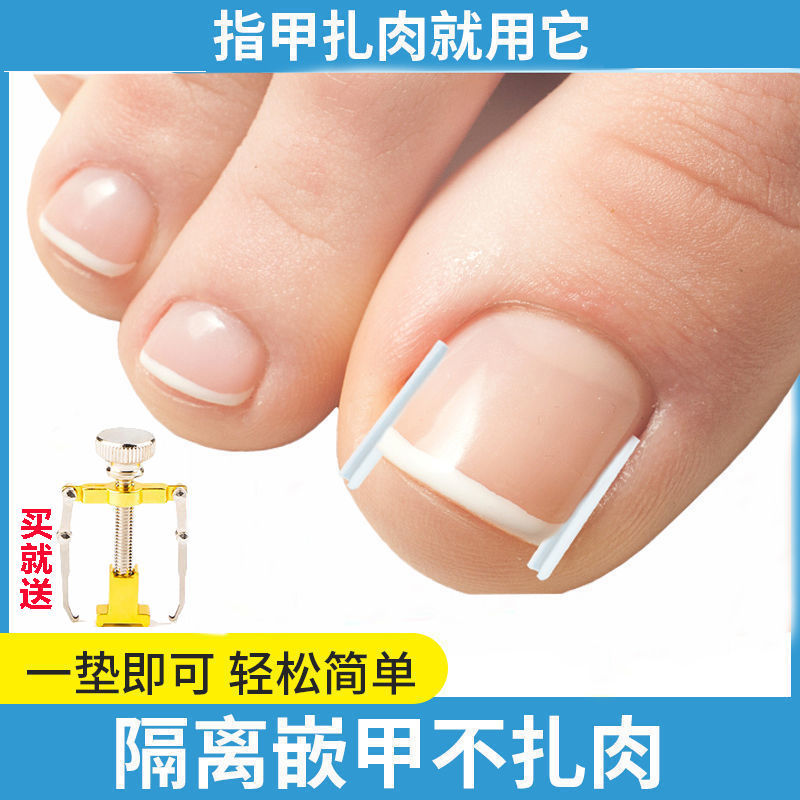 Metal Diagritis Filled Foot Nails to Meat Long Corrected Artificial Artistic Artistic Artistic Artistic Artistic Pads