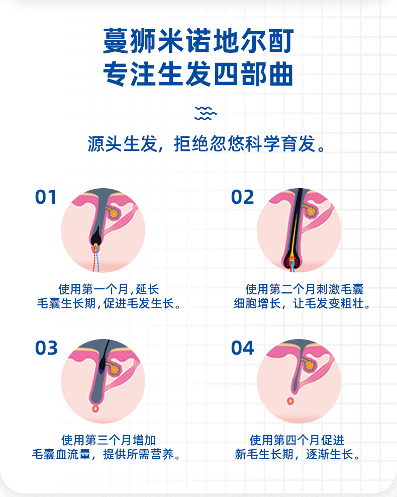国药OTC 蔓狮 米诺地尔酊 防脱生发喷剂 40ml 治疗斑秃管用 图4