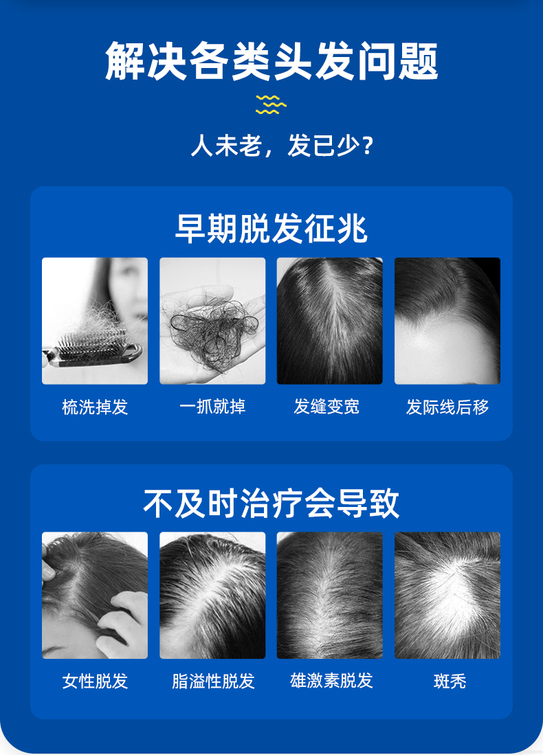 国药OTC 蔓狮 米诺地尔酊 防脱生发喷剂 40ml 治疗斑秃管用 图3